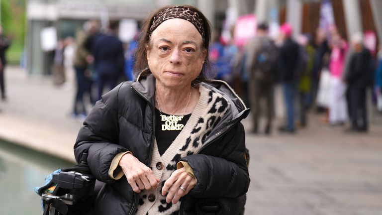 Herečka Liz Carr hovoří s médii před skotským parlamentem v Edinburghu, před debatou a hlasováním o asistovaném umírání.  Pic: Pa