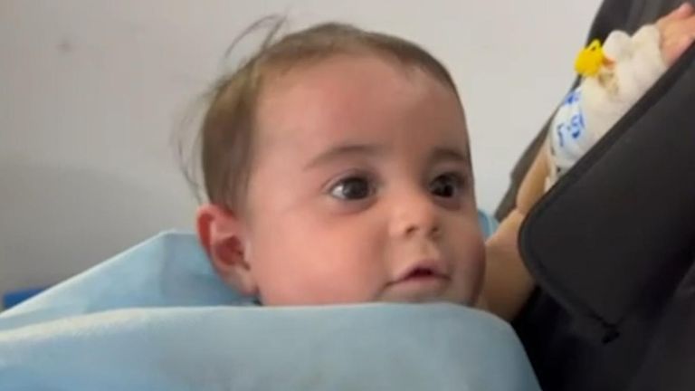 Dítě přivedlo do jednotky Burns v nemocnici Nasser 
