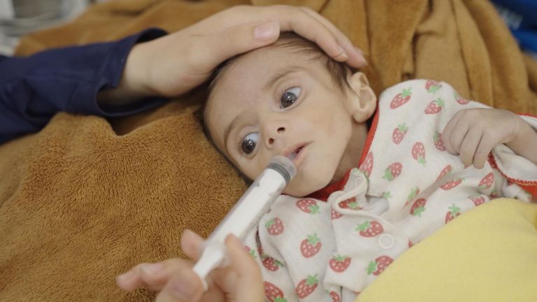 Baby Aya v nemocnici Rantisi v severní Gaze