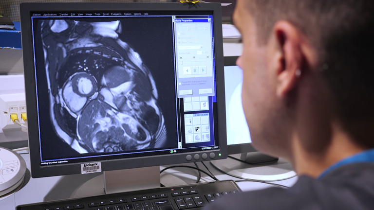 MRI skenuje a technik z britského projektu Biobank