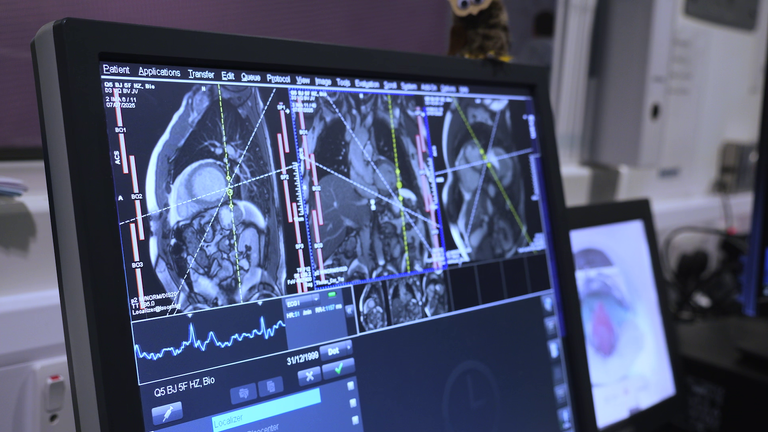 MRI skenuje z projektu Biobank Biobank