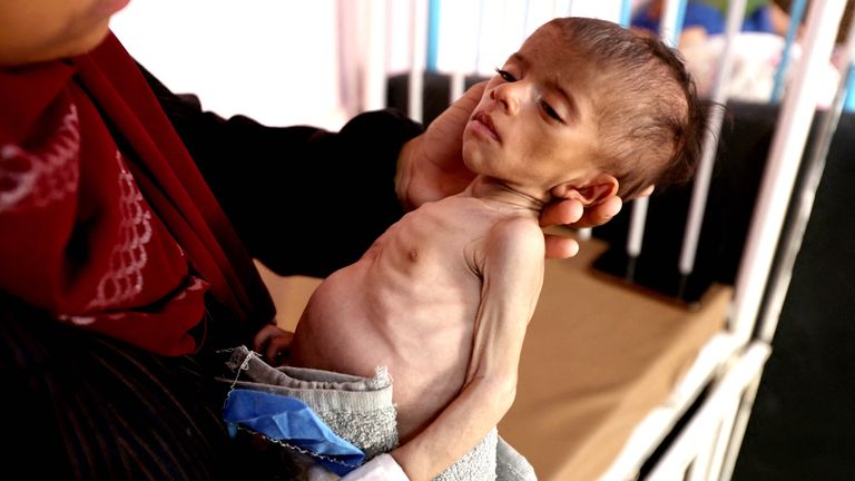Palestinská žena drží svou pětiměsíční dceru Wateen Abu Amoua v nemocnici Nasser v Khan Younis.  Pic: Reuters