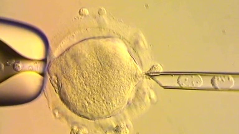 Pochopné obrazovky převzaté z video videa s diagramem zobrazujícím postup nahrazení embrya.