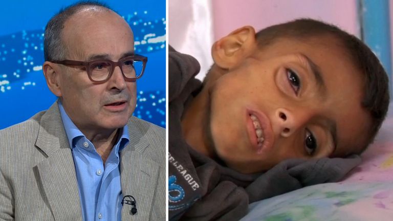 Yalda Hakim Gaza Doctor Chirurg Malnutrition Hladomor Maynard