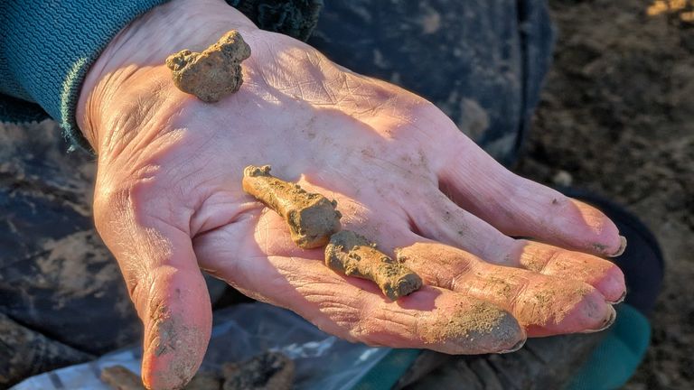 Prsty kosti z oddělené lidské paže nalezené během výkopu. Pic: Pa