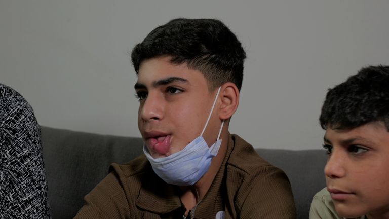 „Pozdravil jsi nás tak pěkným způsobem“ do Velké Británie dorazí dítě Gazan k léčbě
