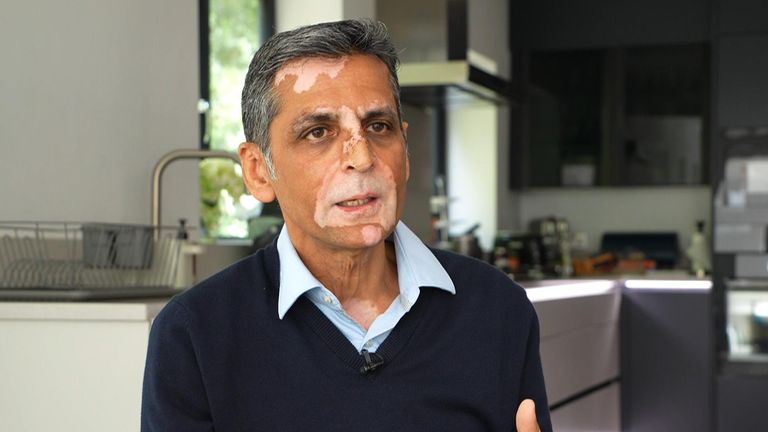 Plast a rekonstrukční chirurg - Waseem Saeed