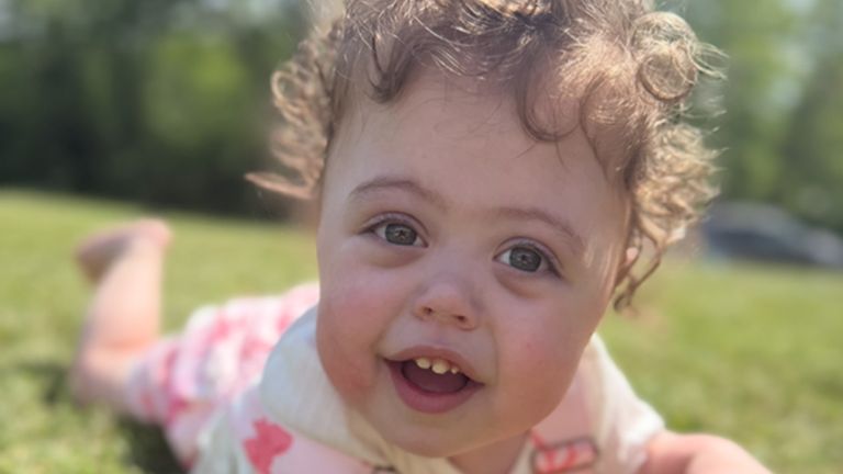 Amelia se narodila s těžkou vrozenou bránicí kýlovou kýlou. Pic: Georgia Turner/PA