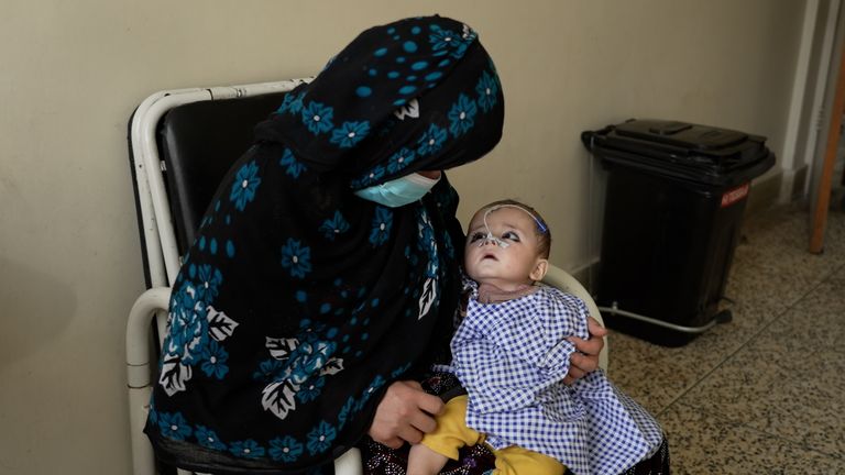 Dítě vzhlédne na svou matku v provinční nemocnici Badakhshan 