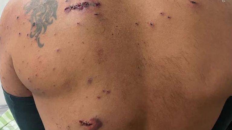 Roei byl dvakrát zastřelen do zad. PIC: Instagram/@Roeishalev