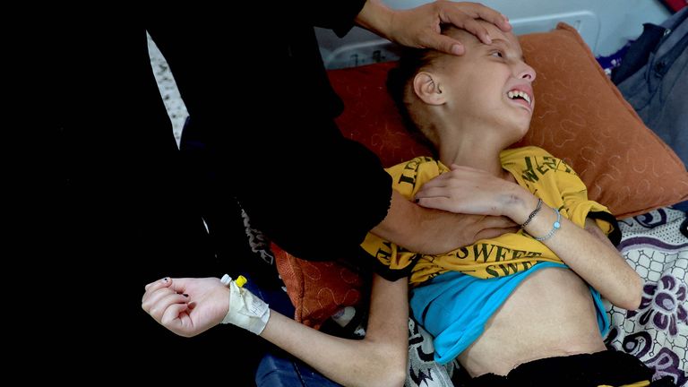 Huda, která byla léčena na podvýživě v nemocnici Nasser v srpnu. Pic: Reuters